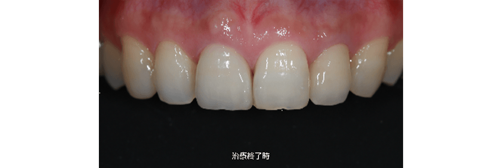 症例1 治療後