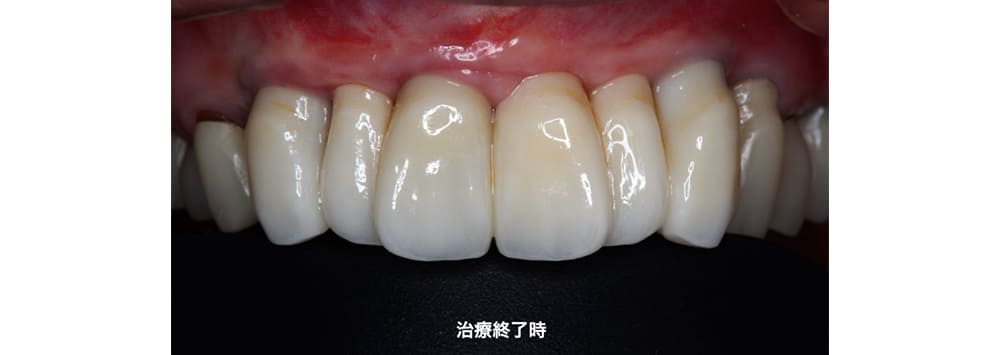 症例2 治療後