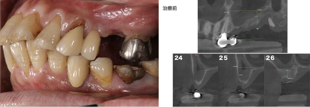 症例3 治療前